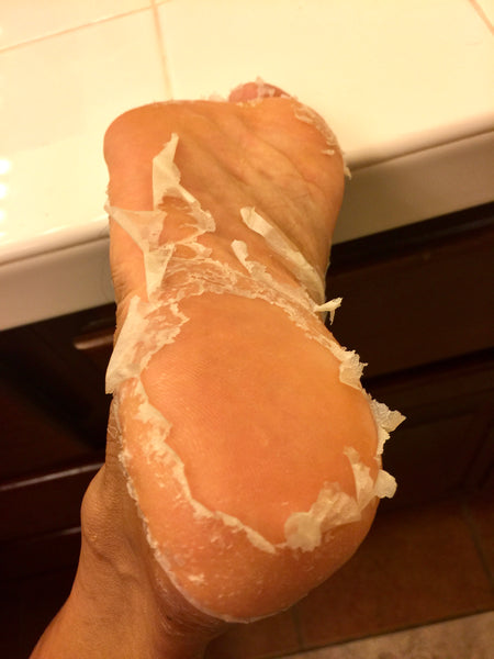 Valentina L.A. Foot Exfoliating Peel