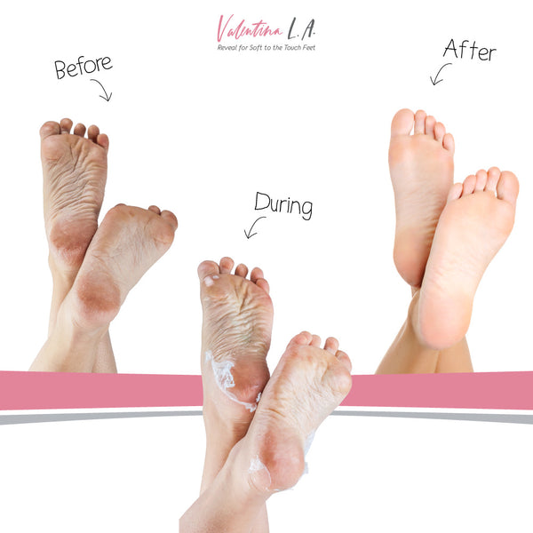 Valentina L.A. Foot Exfoliating Peel